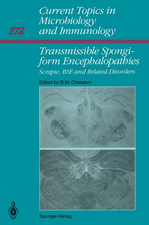 Produktbild: Transmissible Spongiform Encephalopathies: