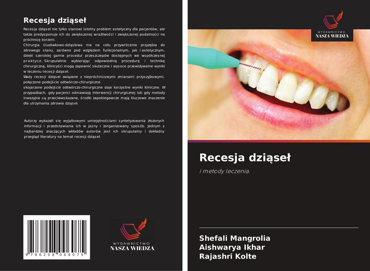 Produktbild: Recesja dzi&iquest;se&iquest;