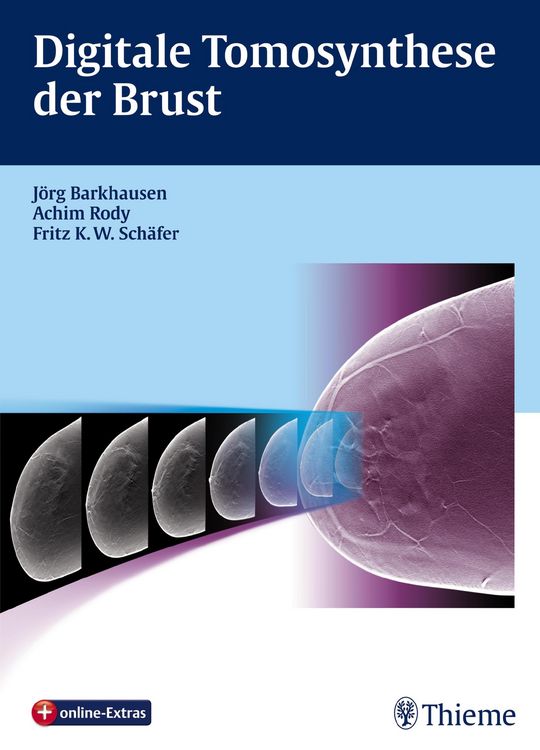 Produktbild: Digitale Tomosynthese der Brust