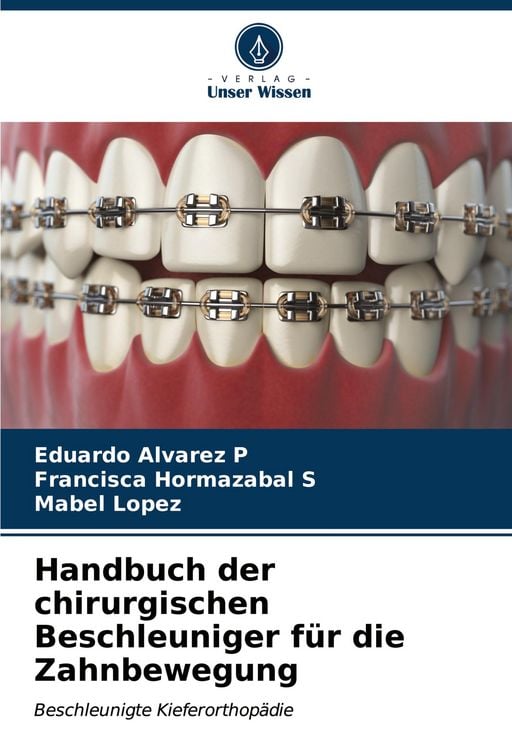 Produktbild: Handbuch der chirurgischen Beschleuniger f&uuml;r die Zahnbewegung
