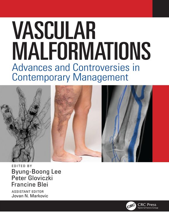 Produktbild: Vascular Malformations