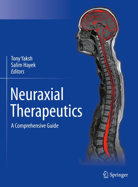 Produktbild: Neuraxial Therapeutics