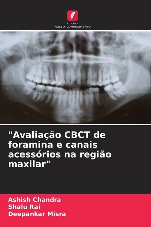 Produktbild: "Avalia&ccedil;&atilde;o CBCT de foramina e canais acess&oacute;rios na regi&atilde;o maxilar"