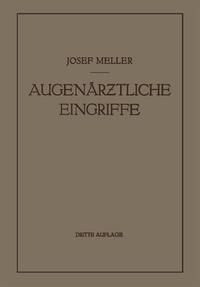 Produktbild: Augen&auml;rztliche Eingriffe