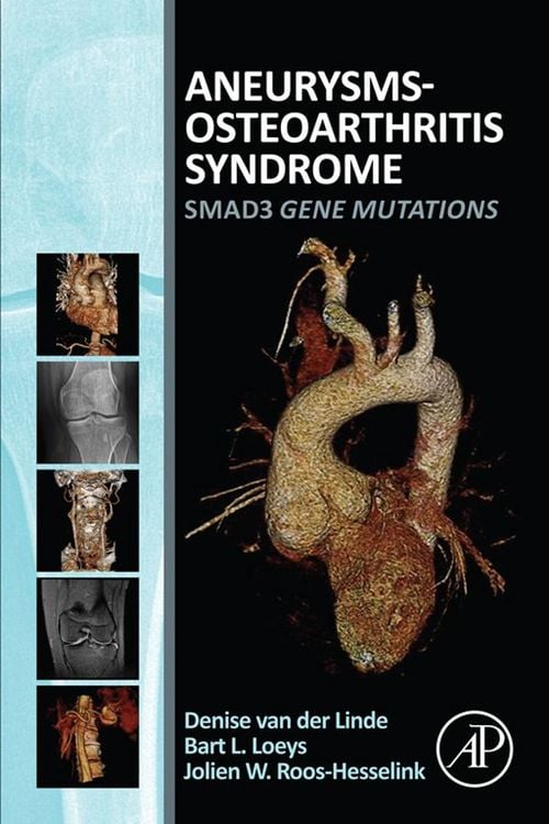 Produktbild: Aneurysms-Osteoarthritis Syndrome