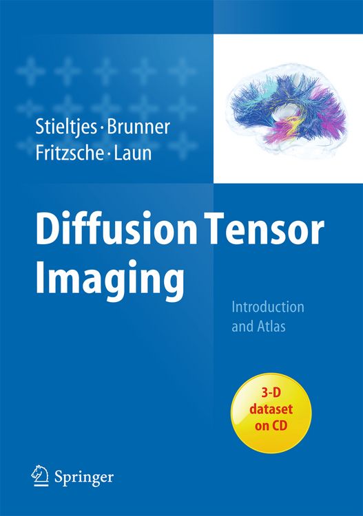 Produktbild: Diffusion Tensor Imaging