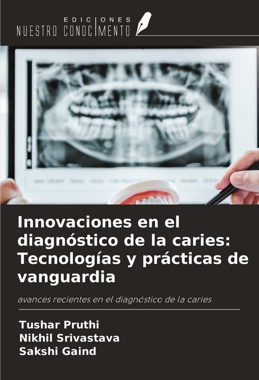 Produktbild: Innovaciones en el diagn&oacute;stico de la caries: Tecnolog&iacute;as y pr&aacute;cticas de vanguardia