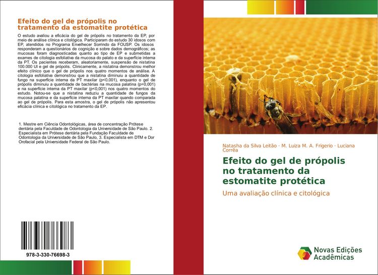 Produktbild: Efeito do gel de pr&oacute;polis no tratamento da estomatite prot&eacute;tica