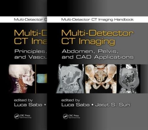 Produktbild: Multi-Detector CT Imaging Handbook, Two Volume Set