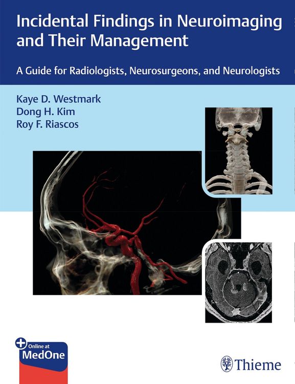 Produktbild: Incidental Findings in Neuroimaging and Their Management