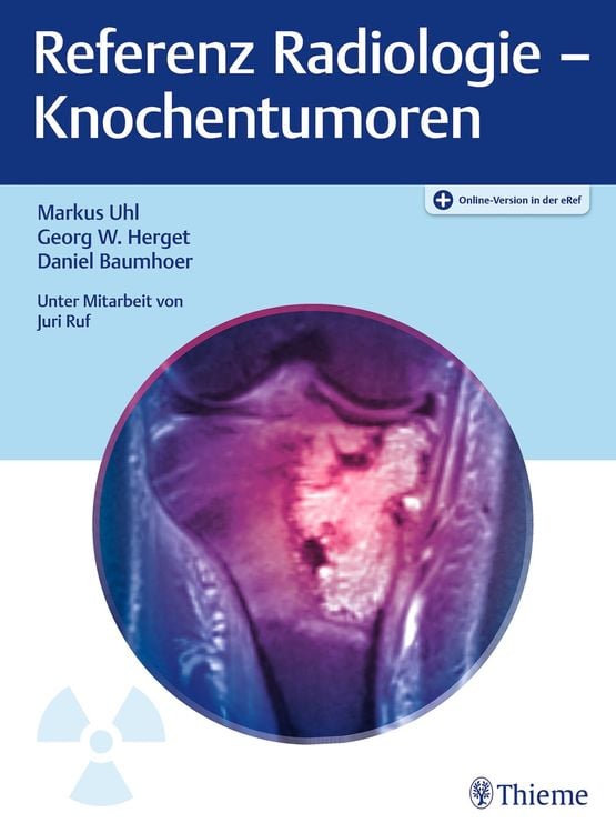 Produktbild: Referenz Radiologie - Knochentumoren