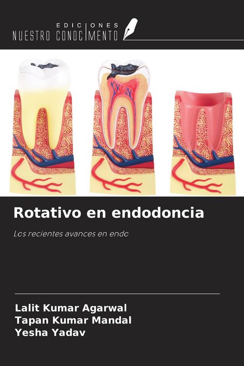 Produktbild: Rotativo en endodoncia
