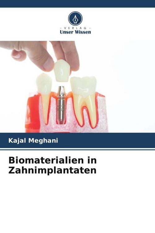 Produktbild: Biomaterialien in Zahnimplantaten