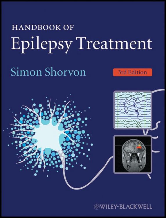 Produktbild: Handbook of Epilepsy Treatment