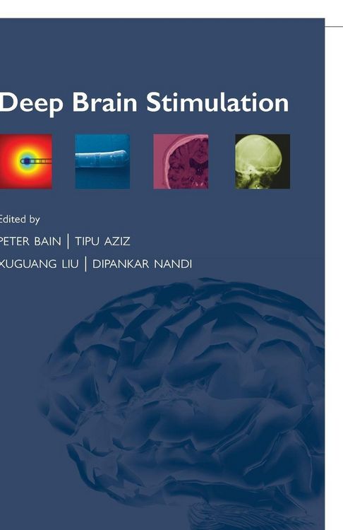 Produktbild: Deep Brain Stimulation