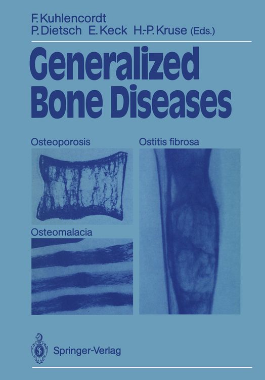 Produktbild: Generalized Bone Diseases