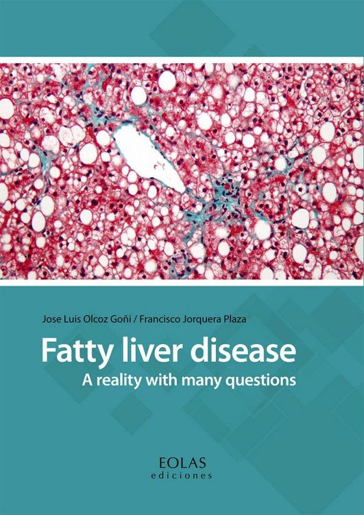 Produktbild: Fatty liver disease : a reality with many questions