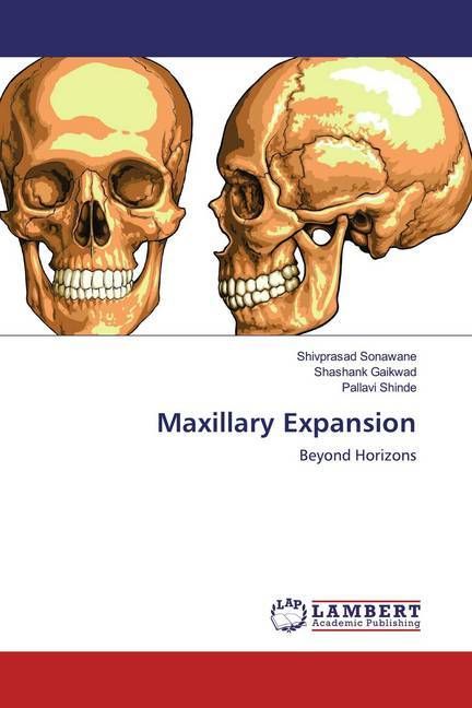 Produktbild: Sonawane, S: Maxillary Expansion