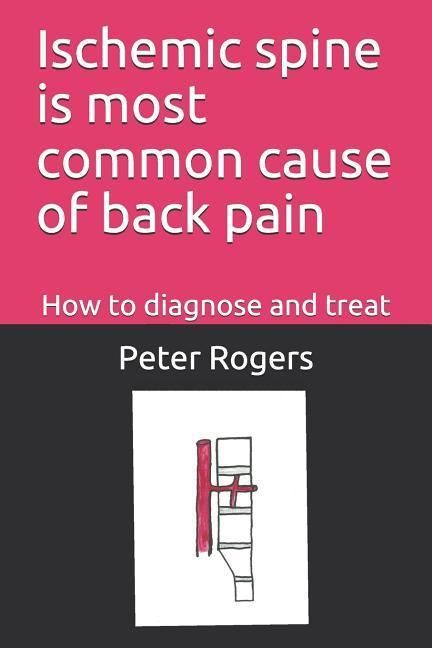 Produktbild: Ischemic Spine Is Most Common Cause of Back Pain: How to Diagnose and Treat