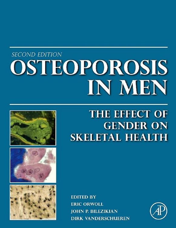 Produktbild: Osteoporosis in Men