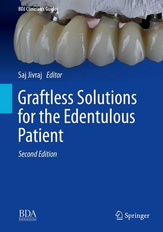 Produktbild: Graftless Solutions for the Edentulous Patient