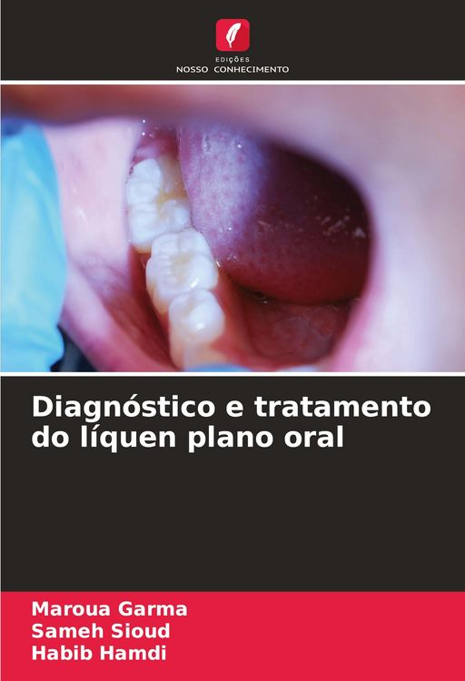 Produktbild: Diagn&oacute;stico e tratamento do l&iacute;quen plano oral