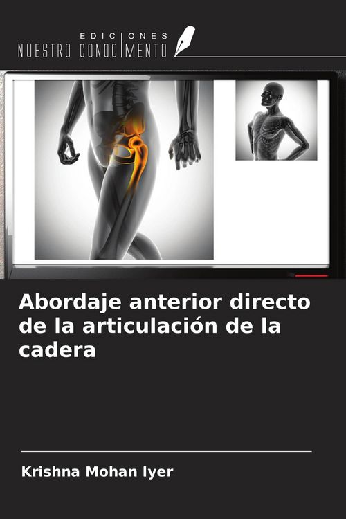 Produktbild: Abordaje anterior directo de la articulaci&oacute;n de la cadera
