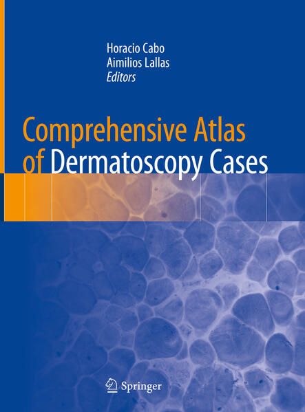 Produktbild: Comprehensive Atlas of Dermatoscopy Cases