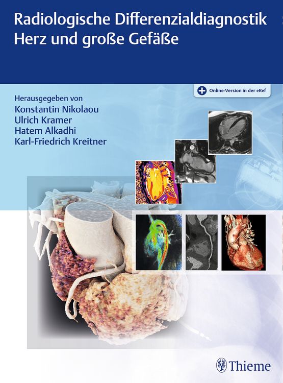 Produktbild: Radiologische Differenzialdiagnostik Herz und gro&szlig;e Gef&auml;&szlig;e