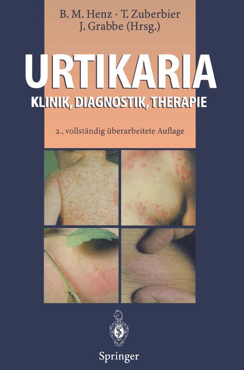 Produktbild: Urtikaria