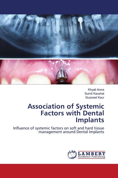 Produktbild: Association of Systemic Factors with Dental Implants
