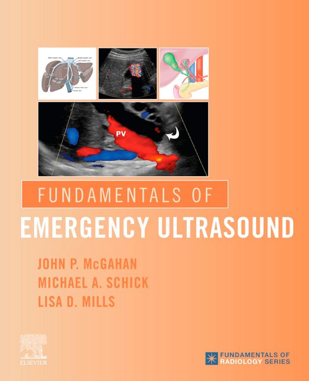 Produktbild: Fundamentals of Emergency Ultrasound