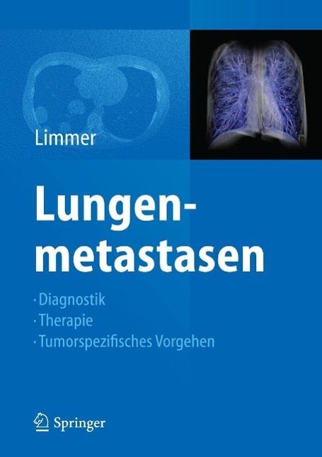 Produktbild: Lungenmetastasen