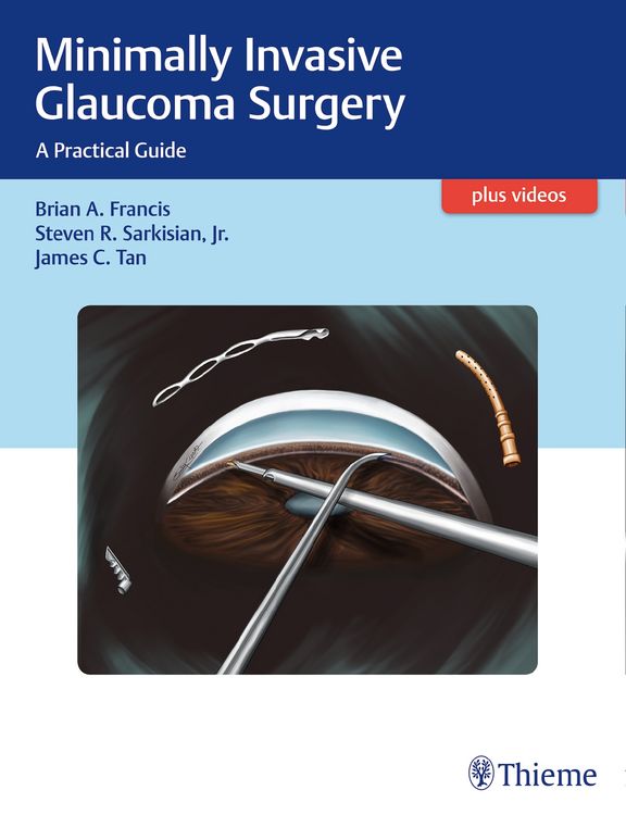 Produktbild: Minimally Invasive Glaucoma Surgery
