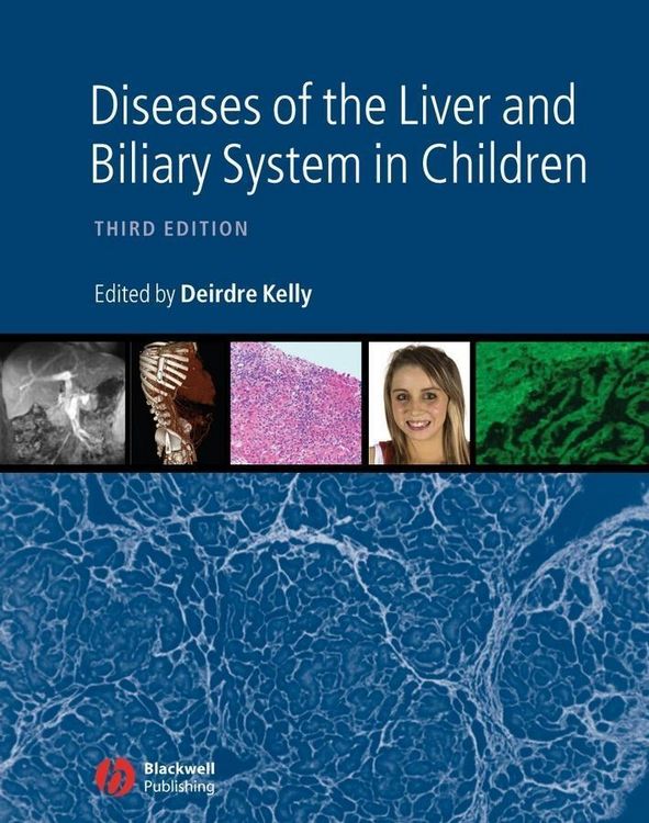 Produktbild: Diseases of the Liver and Biliary System in Children