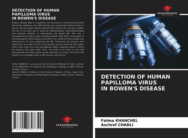 Produktbild: DETECTION OF HUMAN PAPILLOMA VIRUS IN BOWEN'S DISEASE