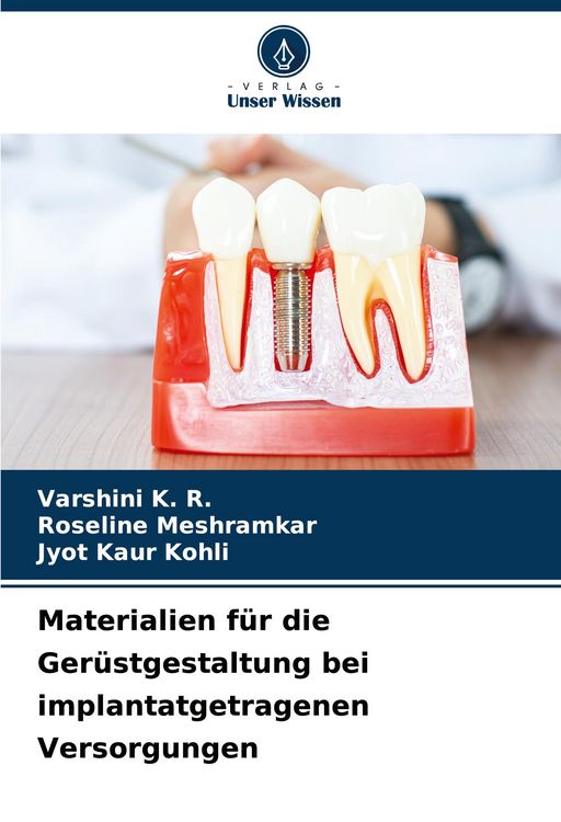 Produktbild: Materialien f&uuml;r die Ger&uuml;stgestaltung bei implantatgetragenen Versorgungen