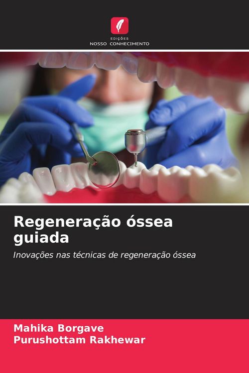 Produktbild: Regenera&ccedil;&atilde;o &oacute;ssea guiada