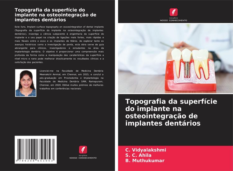 Produktbild: Topografia da superf&iacute;cie do implante na osteointegra&ccedil;&atilde;o de implantes dent&aacute;rios