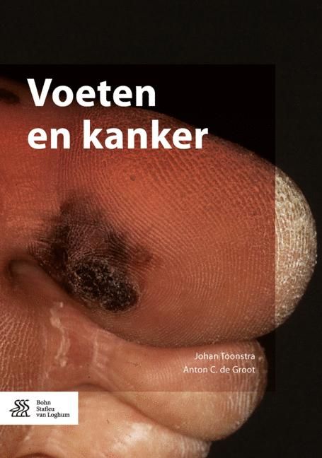 Produktbild: Voeten en kanker