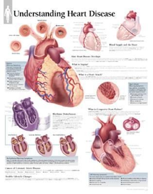 Produktbild: UNDERSTANDING HEART DISEASE CH