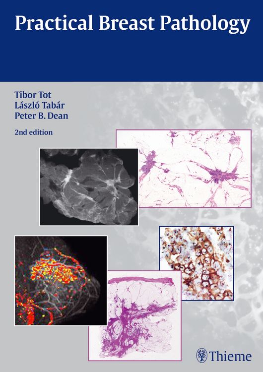 Produktbild: Practical Breast Pathology