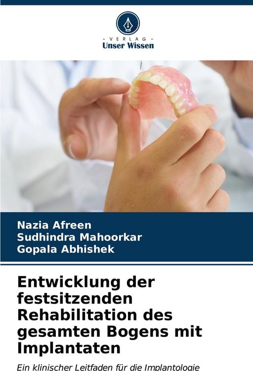 Produktbild: Entwicklung der festsitzenden Rehabilitation des gesamten Bogens mit Implantaten