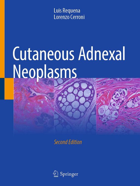 Produktbild: Cutaneous Adnexal Neoplasms