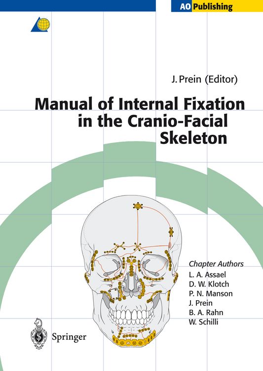 Produktbild: Manual of Internal Fixation in the Cranio-Facial Skeleton