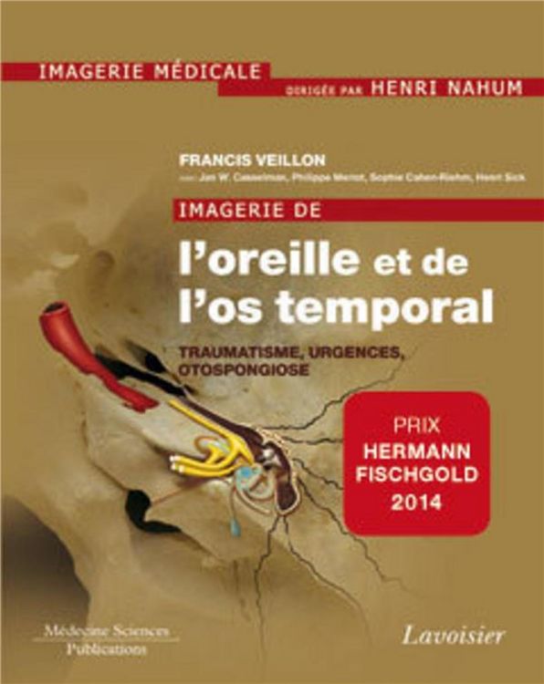 Produktbild: Imagerie de l'oreille et de l'os temporal vol 3 Traumatologie, urgence