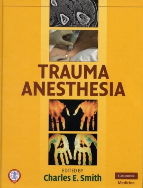 Produktbild: Trauma Anesthesia