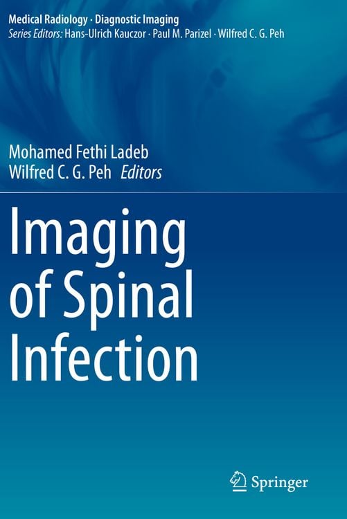 Produktbild: Imaging of Spinal Infection