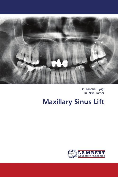 Produktbild: Maxillary Sinus Lift
