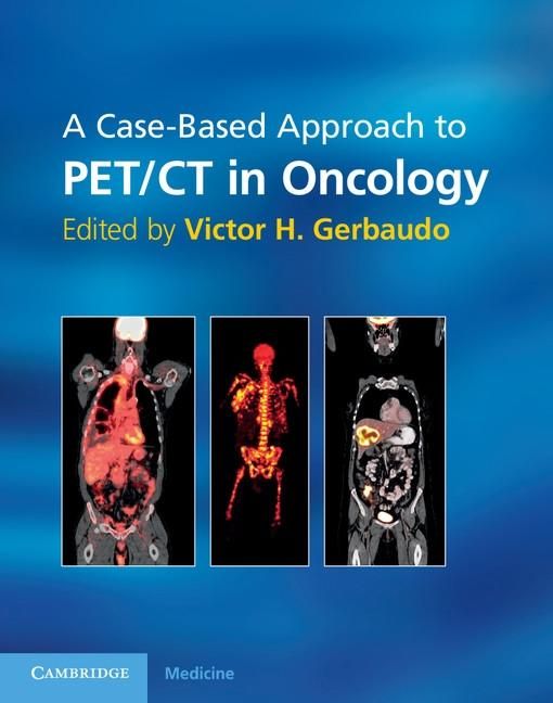 Produktbild: Case-Based Approach to PET/CT in Oncology